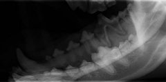 Röntgenbild Unterkiefer mit abgestorbenem Zahn (M1)
